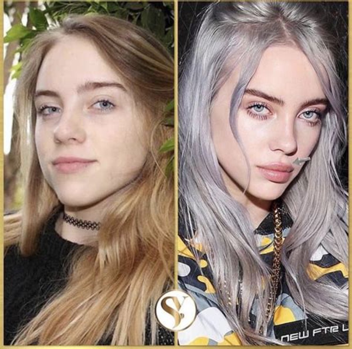 Billie Eilish Breast Reduction: a Journey Towards Self-Acceptance