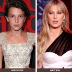 How Did Millie Bobby Brown Look Before and After Plastic Surgery