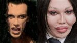 Pete Burns' Cause of Death Explored