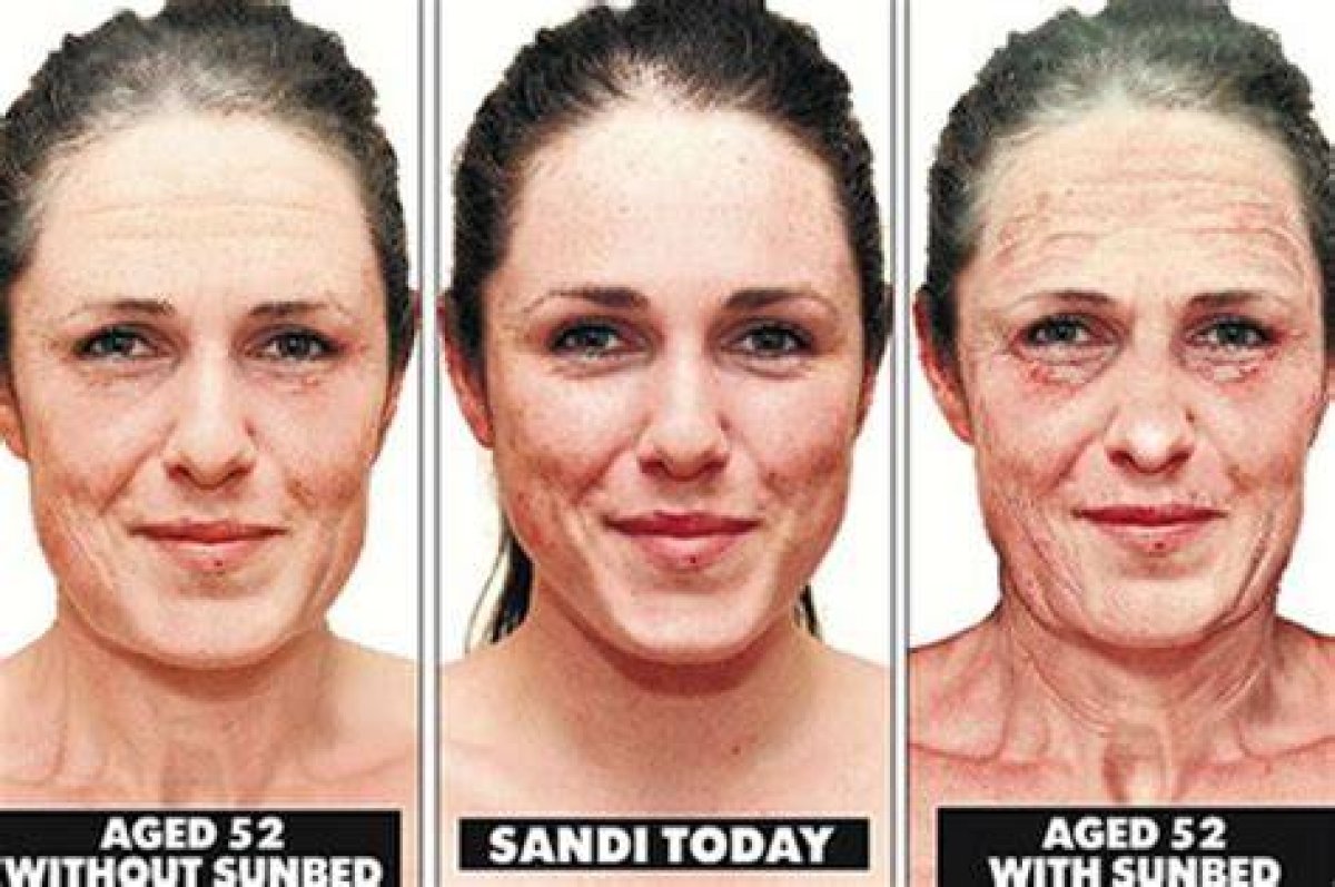 Tanning Bed Before and After 1 Week: Uncover the Surprising Revelations