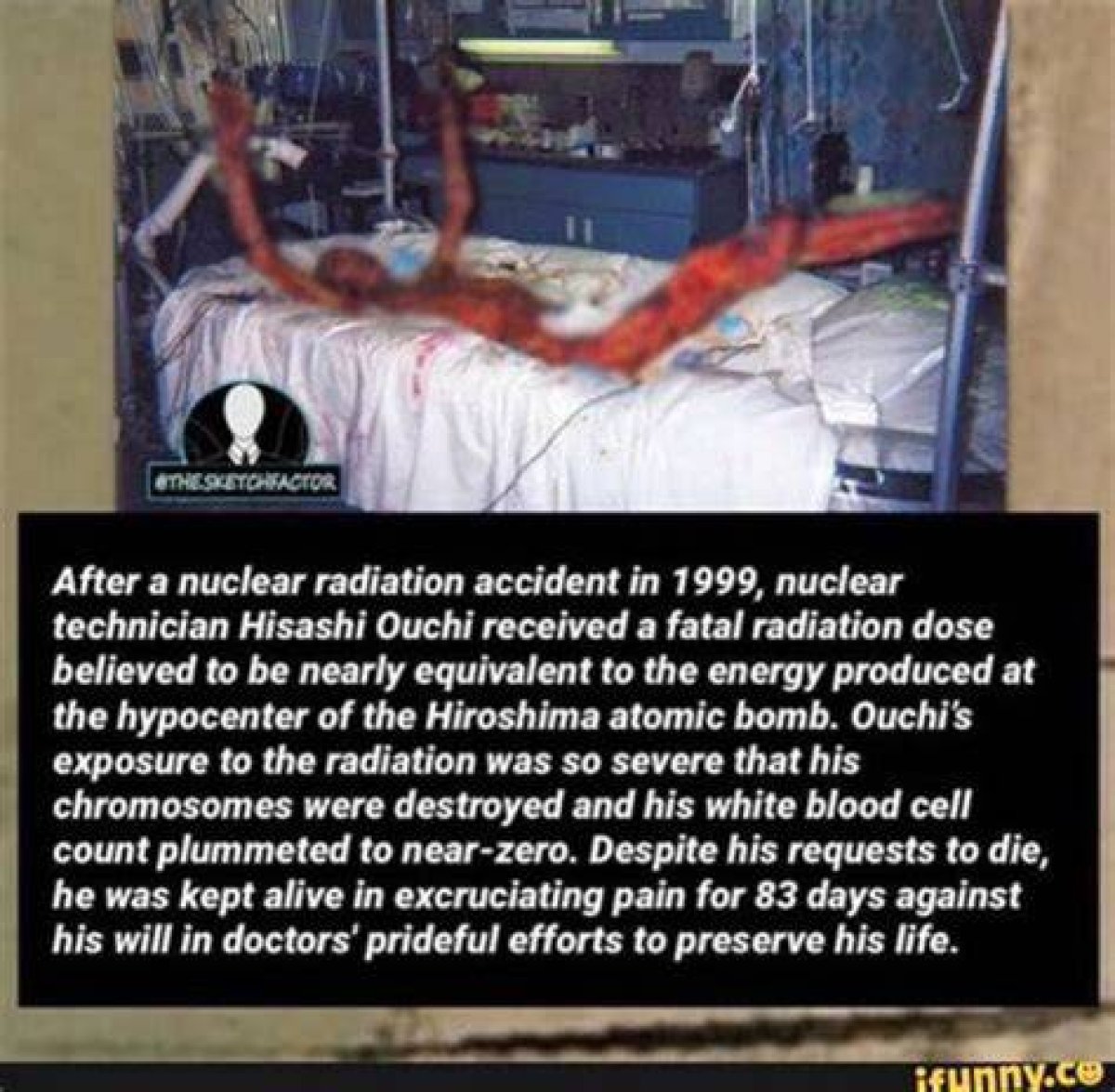 Unraveling the Mysteries of Radiation Ouchi